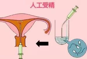 阳江捐卵试管生男孩