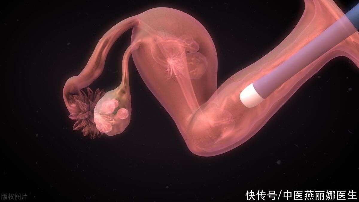 捐卵