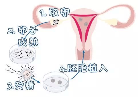 台州捐卵试管中心医院