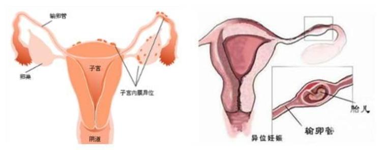 捐卵中心