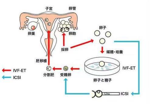 沈阳捐卵机构