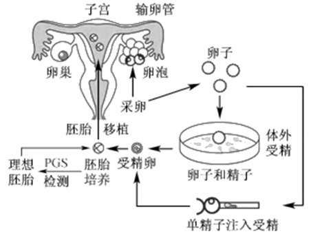 取卵手术