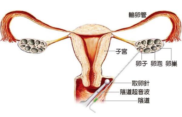 兰州辅助生殖