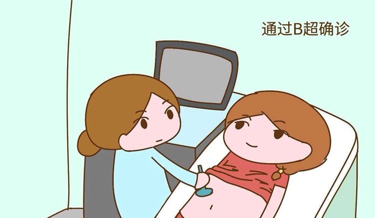 上海有偿捐卵招聘