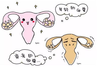 试管婴儿