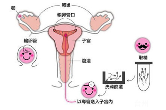 卵子